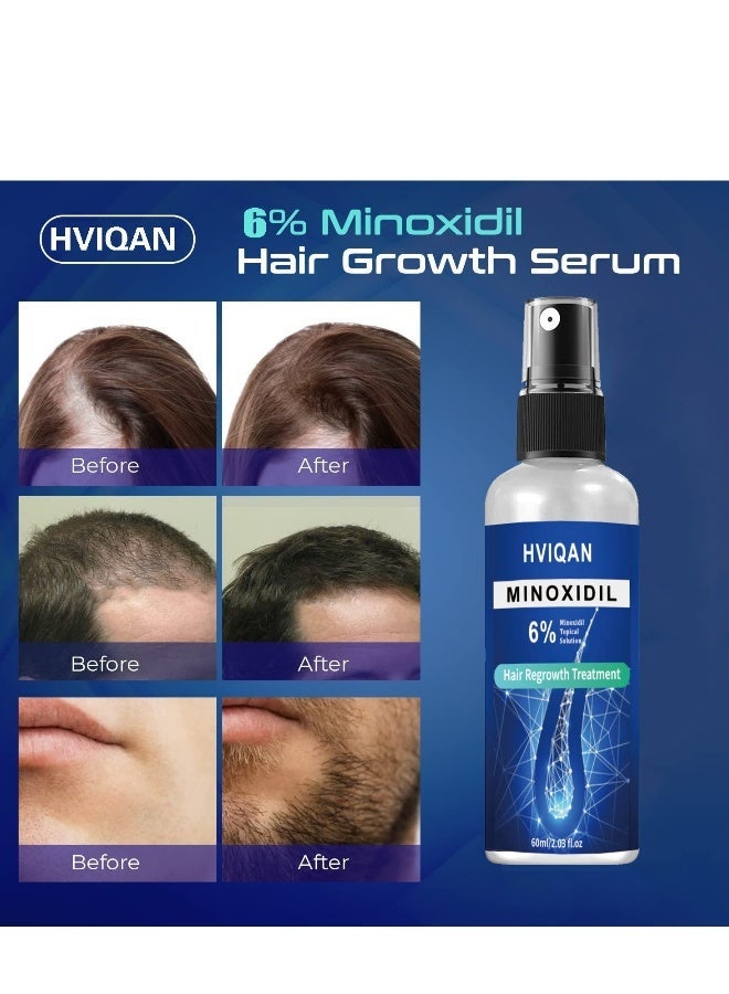 Hviqan 6% Minoxidil Hair Growth Spray For Men and Women 60Ml Hair Regrowth Treatment Serum For Stronger Thicker Longer Hair Help to Stop Thinning and loss hair The image upgrade is slightly different. - Image 3